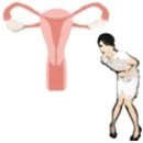 ¿De qué manera se presenta el Síndrome Premenstrual (SPM)?